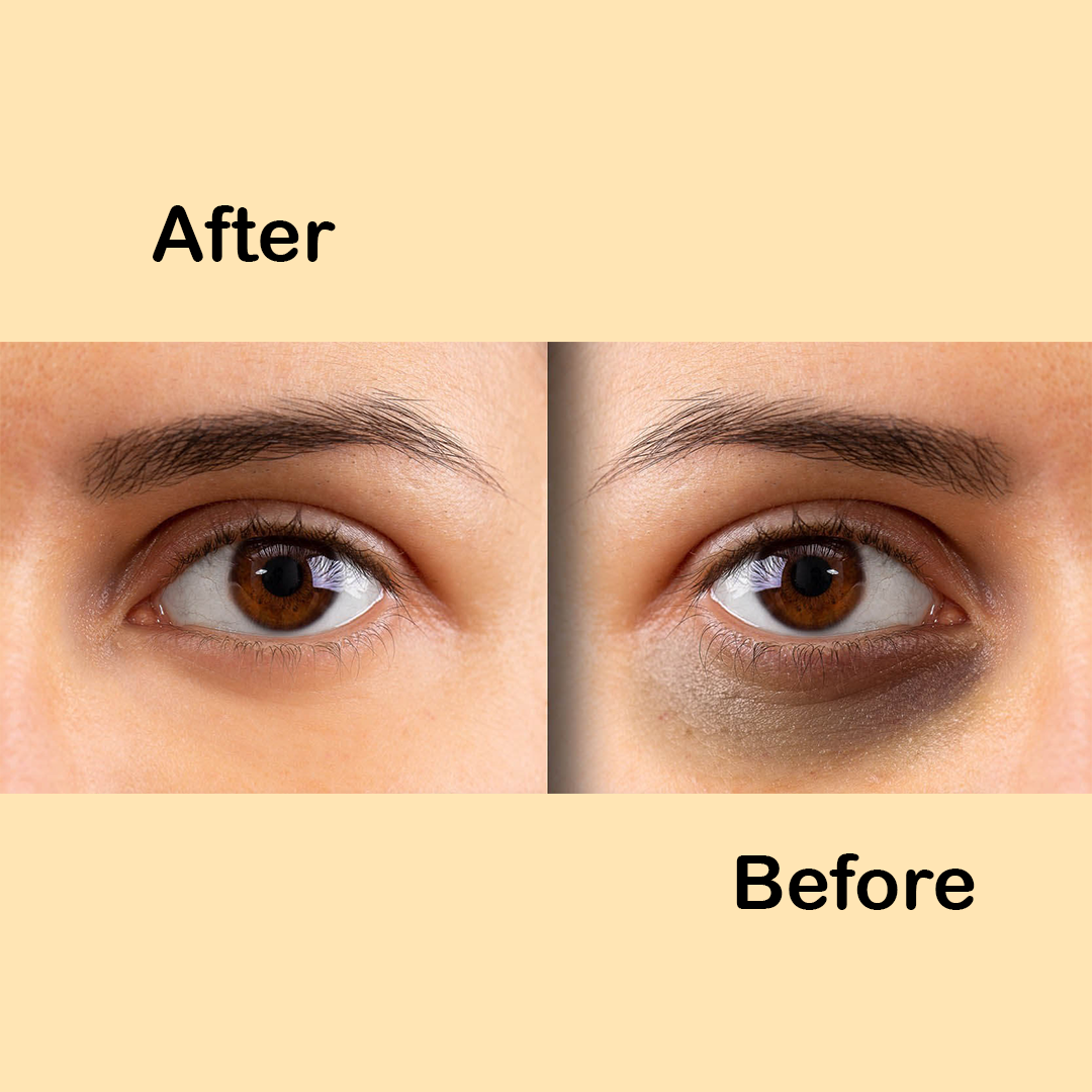 Opal Eyes – Dark Circle & Under-Eye Brightening Serum